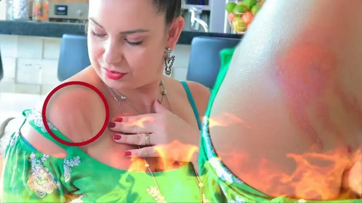 Receita de Limão: Como Evitar Acidentes e Aproveitar o Sabor Sem Perigo